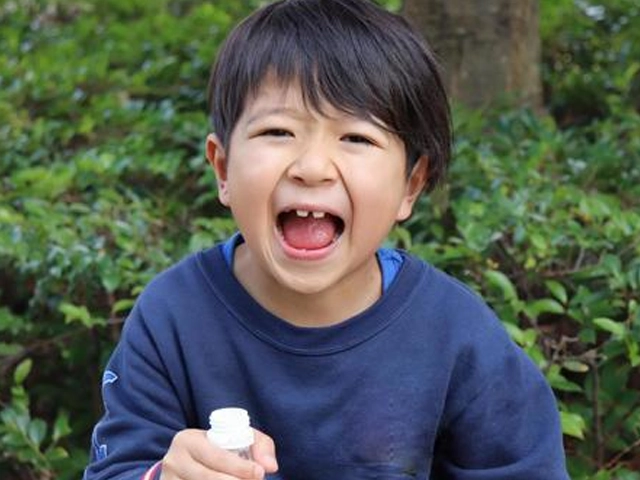 すきっ歯の小学生