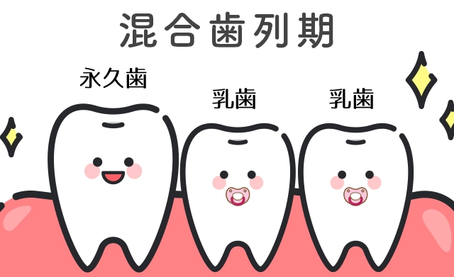 混合歯列期のイメージ