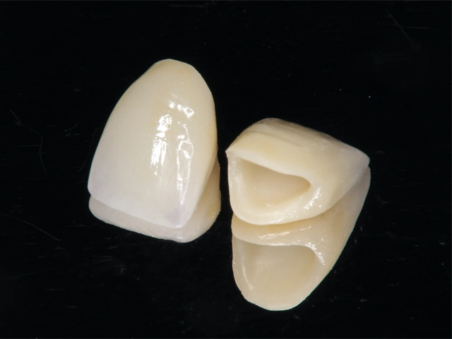 前歯に使うセラミックの被せ物