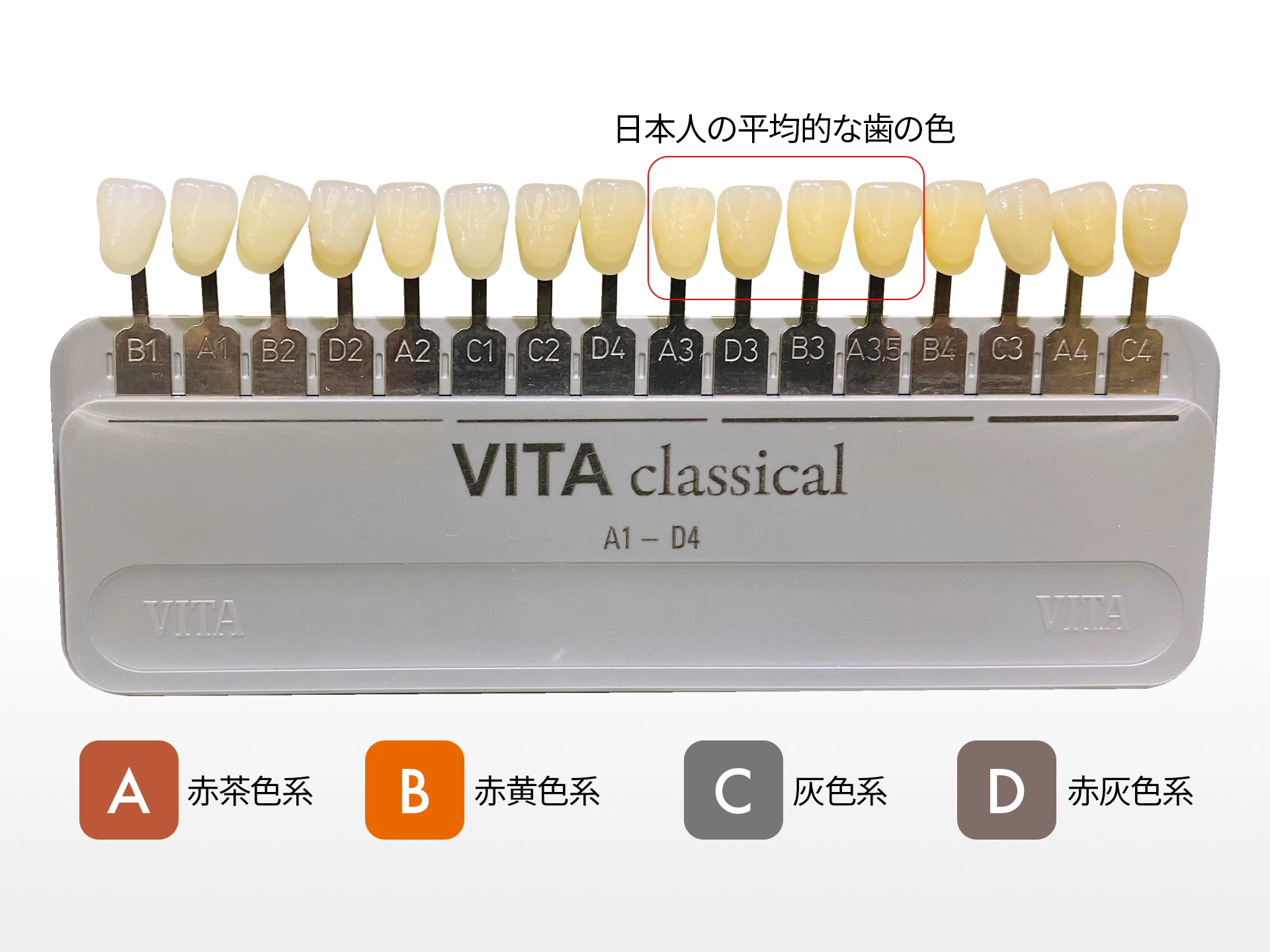 歯の色味をチェックするシェードガイドと歯の色の系統を表した図