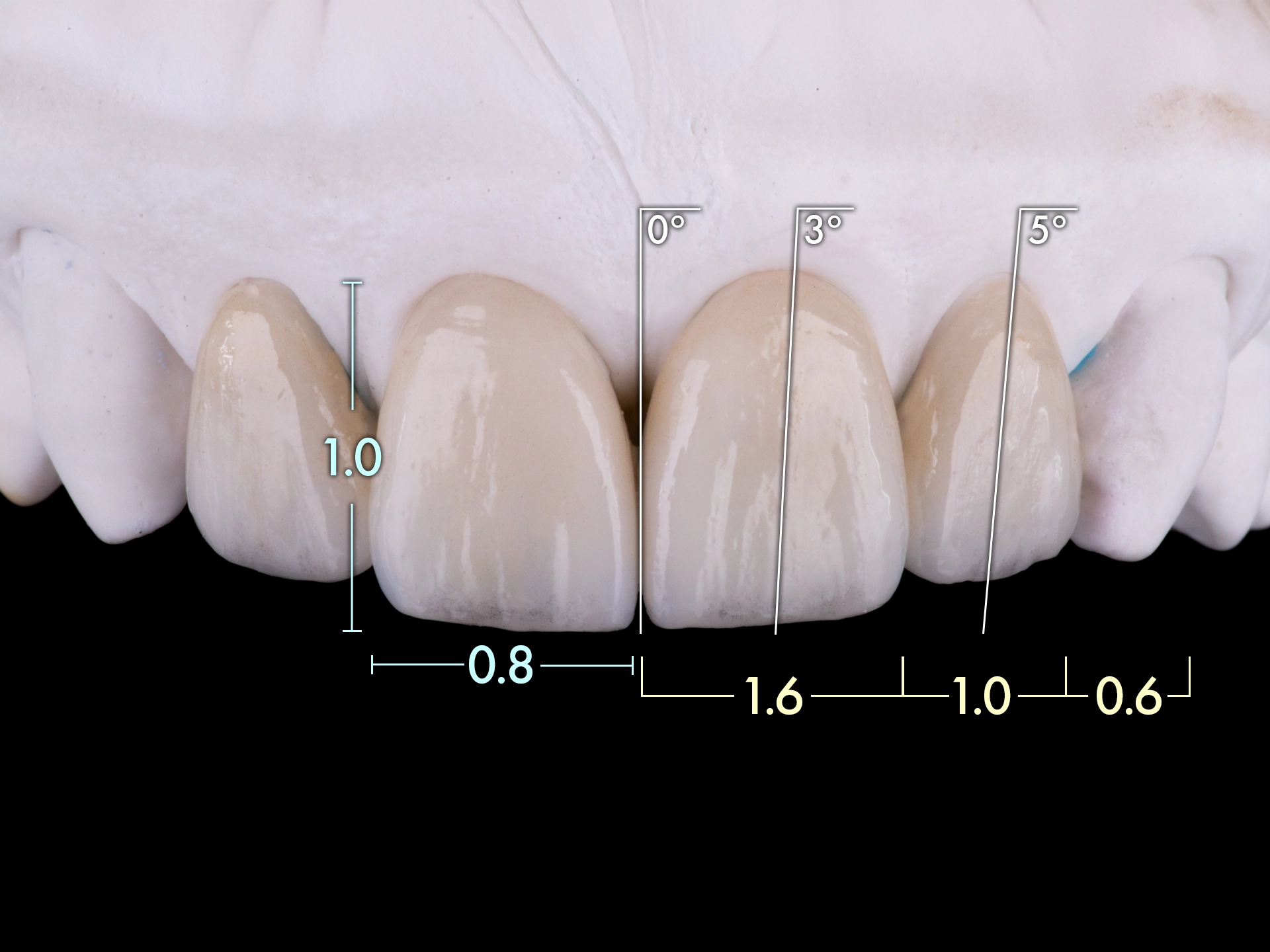 歯の美しさに関わる形状や比率、角度を表した図