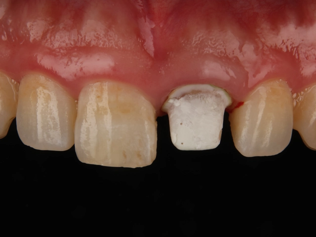 セラミック治療による被せ物の装着前