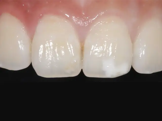 アイコン治療前