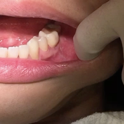 粘膜を揺らす様子