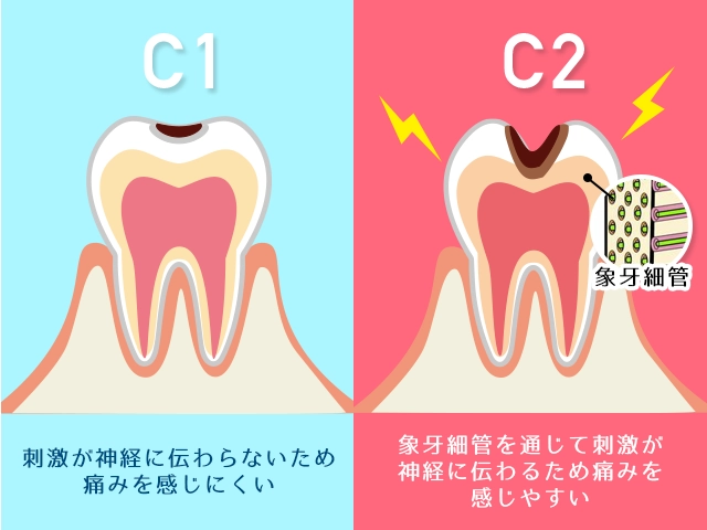 C1とC2の比較